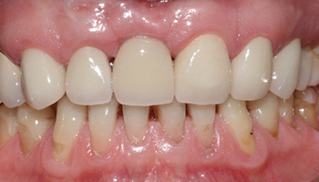 Healthy repaired smile