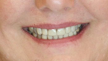 Healthy bright white smile