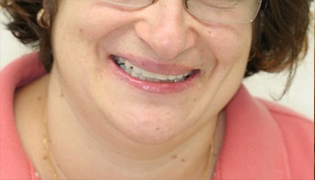 Woman with bright white smile