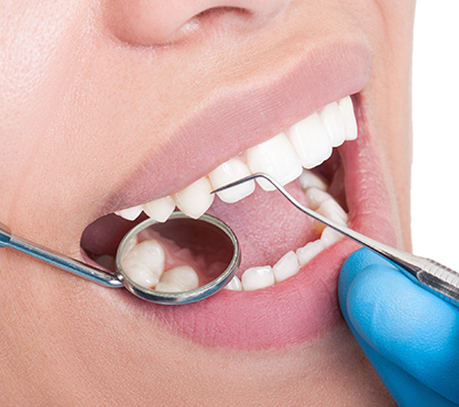 Close up of smile during dental exam