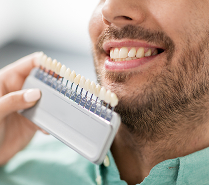 Closeup of smile compared to tooth color chart