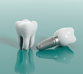 model of a real tooth next to a dental implant