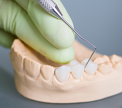 Model of the mouth with a fixed bridge