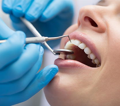 Close up of smile during dental exam