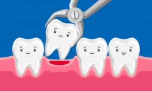 a cartoon image illustrating tooth extraction 